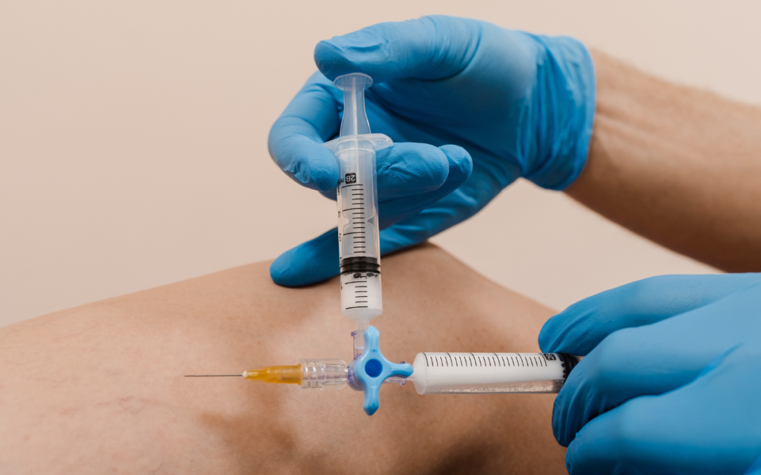 Skleroterapia w leczeniu żylaków