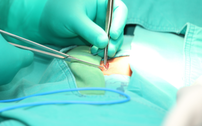 Operacja przepukliny